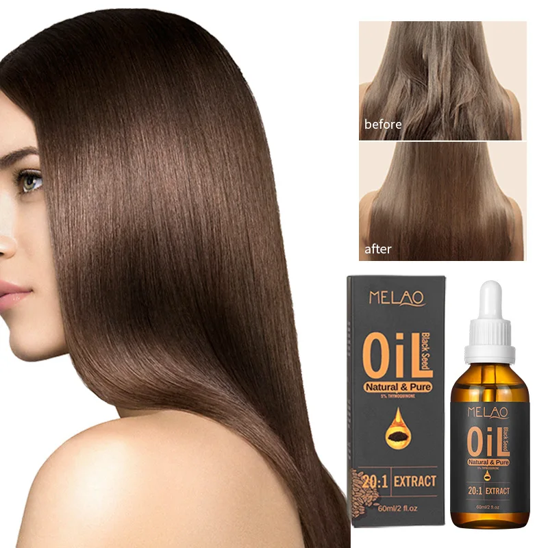 Turkish Black Cumin Seed Oil, Premium Cold Pressed Black Seed Oil - 100% Pure for Skin Care, Hair Growth