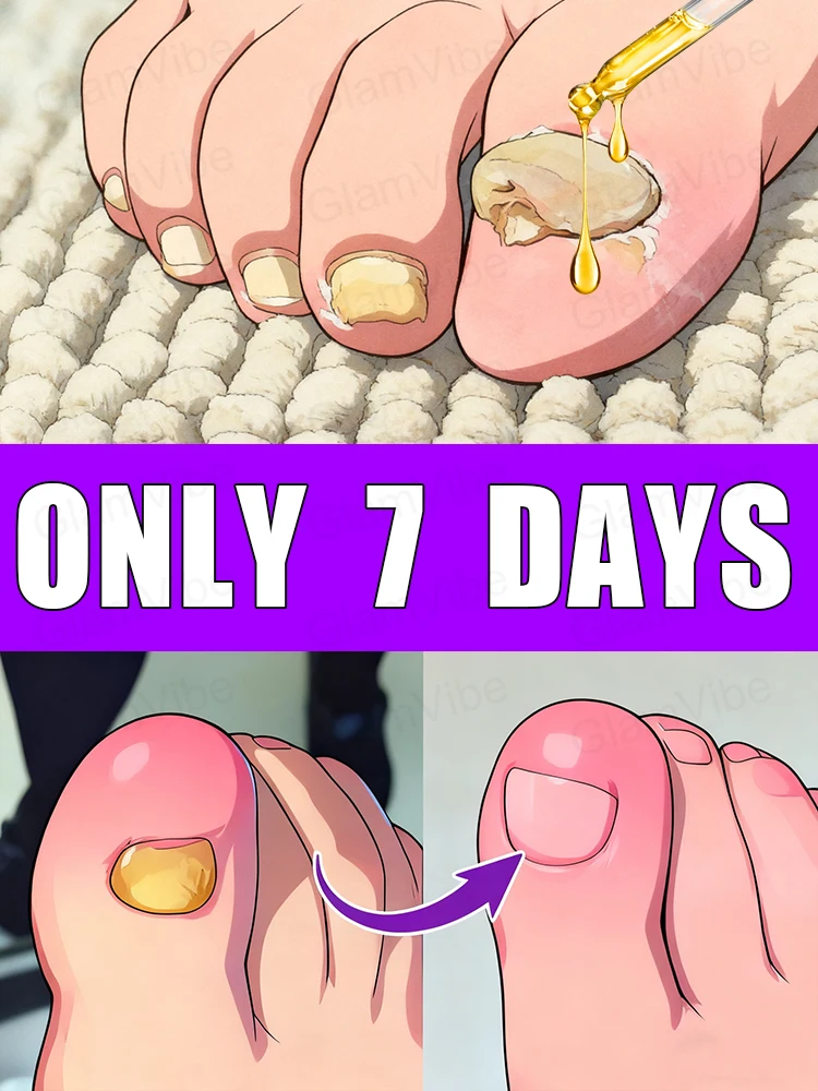 uick Treatmentay وداعًا لقلق الأظافر بشكل فطري، فرشاة تنظيف الأظافر الأكثر مبيعًا #1