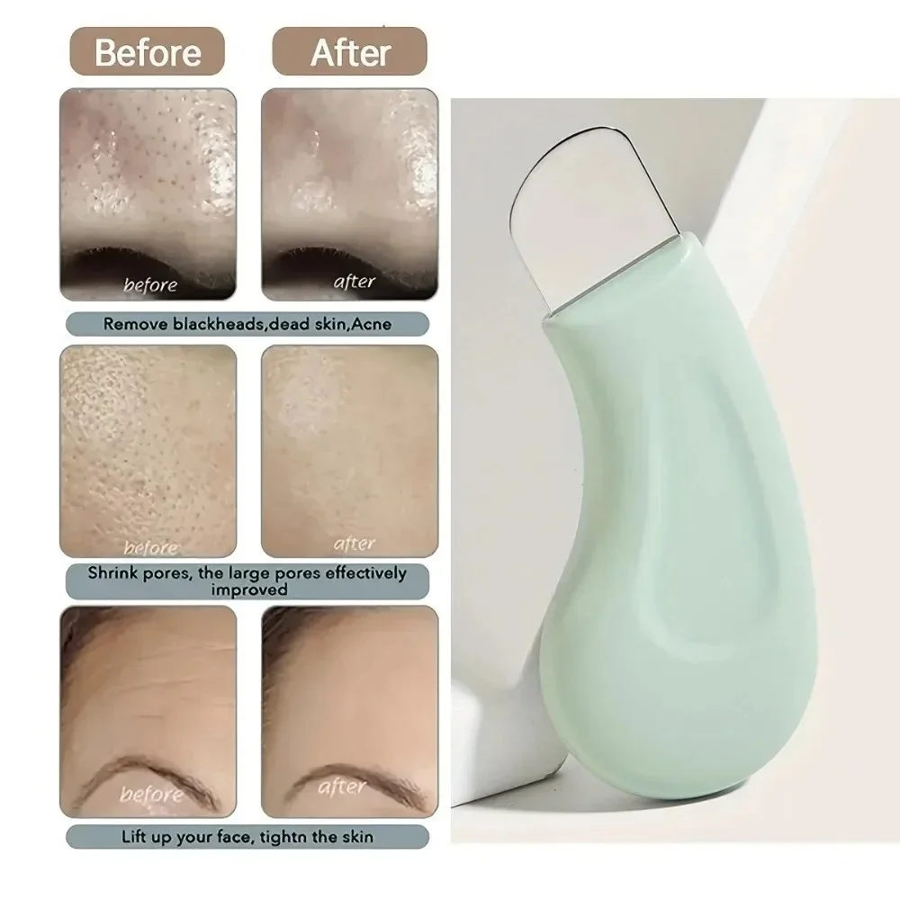 Ferramenta para Remoção de Cravos e Espinhas para Nariz e Rosto - Limpador de Poros para Cuidados com a Pele Feminina, Limpador Facial Suave