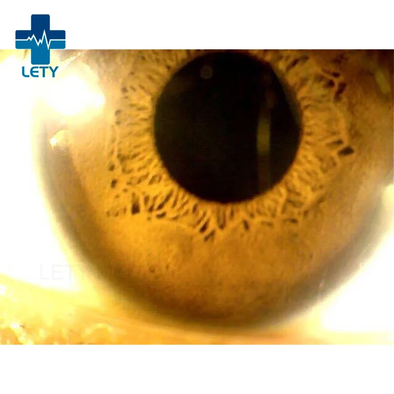 WIFI Ophthalmoscope wireless Iris endoscopy wireless portable digital microscope