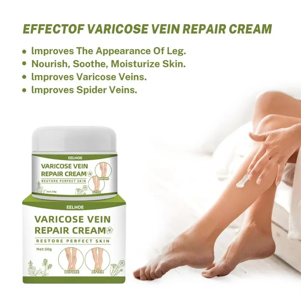 Crema riparatrice per vene varicose Spray riparatore Allevia il dolore alle gambe Gonfiore Migliora lombrico delle gambe Rigonfiamento varicoso Aumenta la circolazione sanguigna