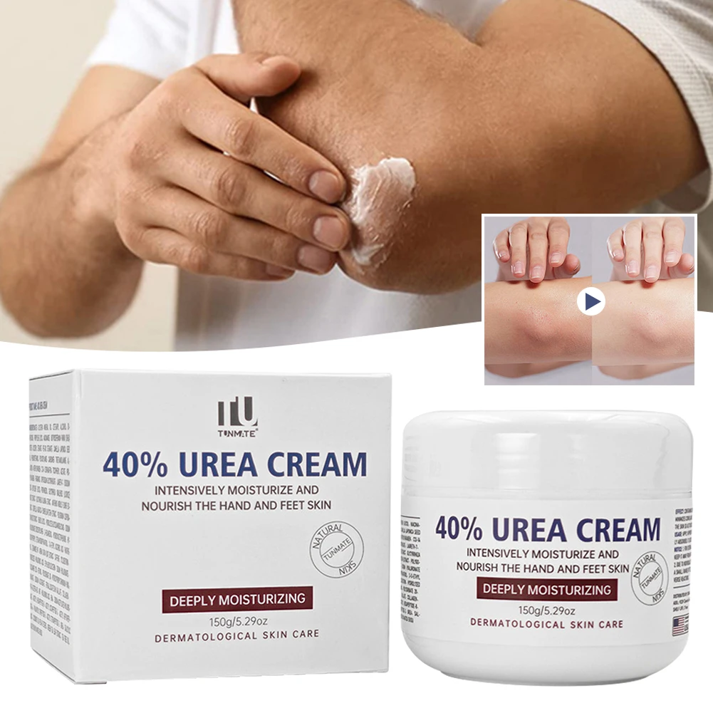 

150 г крем Ureas, 40 процентов для ног, крем для ног для сухих потрескавшихся пяток, глубоко увлажняющий отшелушивающий разглаживающий гель для ухода за телом