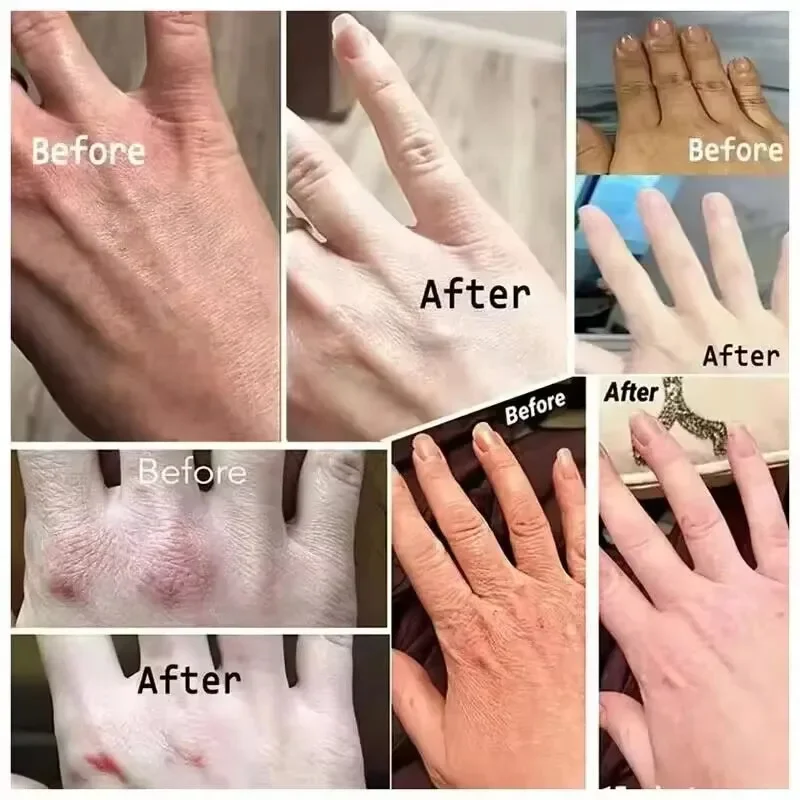 Crème anti-rides pour les mains, adoucit la peau, nourrit, anti-dessèchement, blanchit, hydrate, répare les fissures, produit coréen de soins de la peau