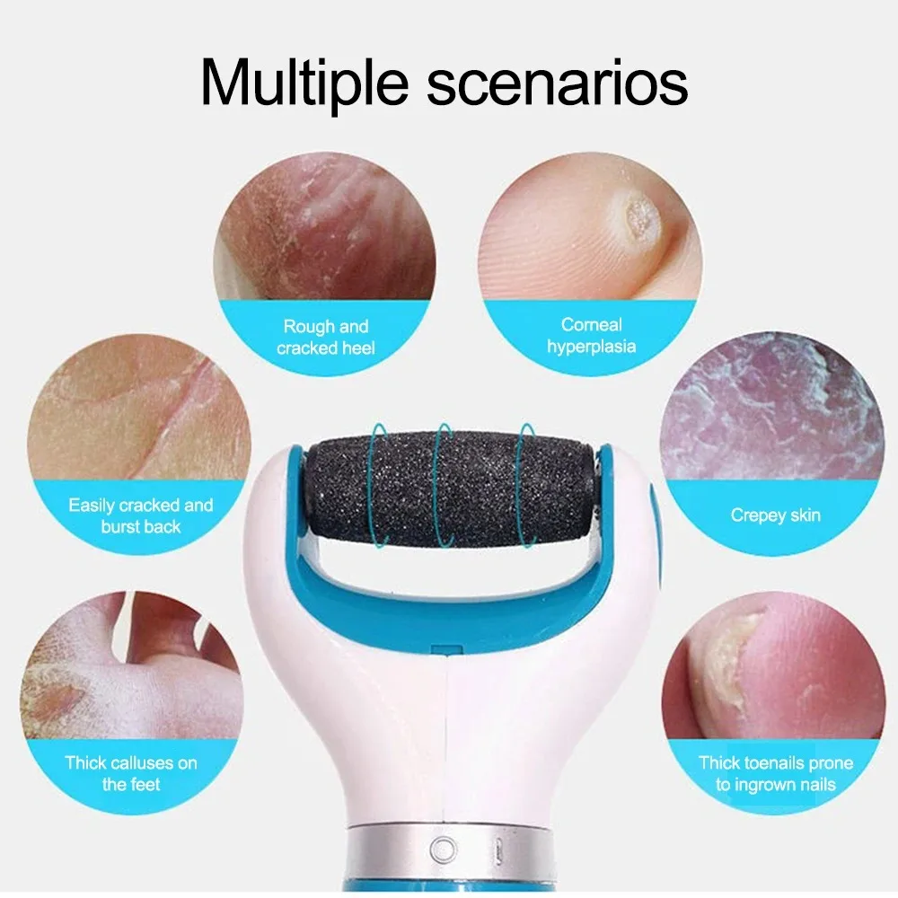 Máquina de cuidados com os pés para pele morta seca dura Removedor de pele de cutícula Ferramentas de cuidados pedicure Arquivo de pés de remoção 1pc