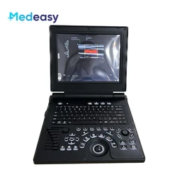 12 Inch HD Display Ultrasound Scanner Portable Color Doppler 3D Ultrasound Pregnancy Machine