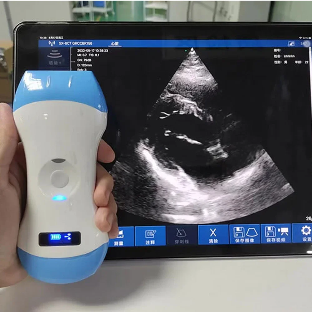 Cardiac Ultrasound Color Linear Array/phased Array 128E Wireless Scanner for Pregnancy, Blood Vessels, Nerves, Musculoskeletal