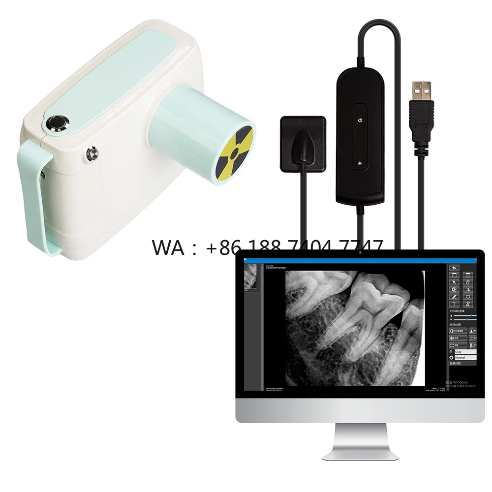 Portable Digital X Ray Machine For Human And Veterinary Medical With LED And Sensor Imaging System