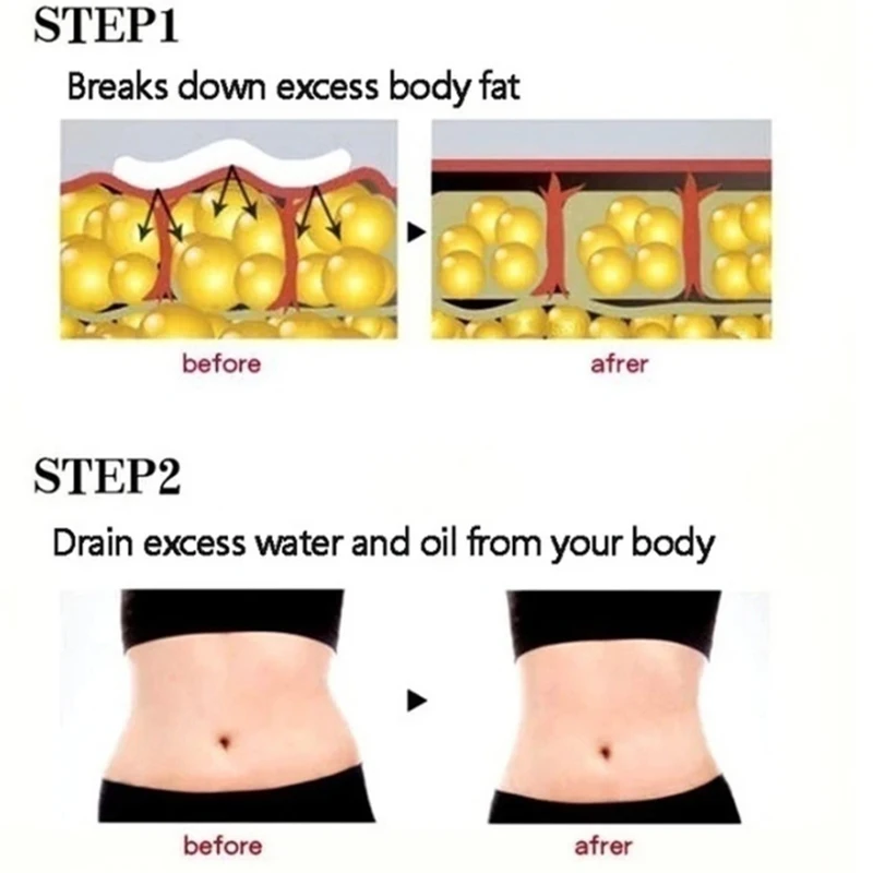 Burn Fat, Chinese Medicine Slimming Patches, Fat Burning, Natural Detox for Men and Women