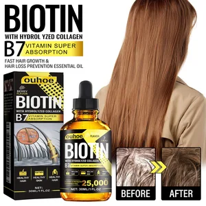 Ouhoe-óleo essencial para o cuidado do cabelo, vitamina b7, hidratação, suaviza, perda de cabelo 10 principais vendas qual melhor tratamento para queda de cabelo - №5