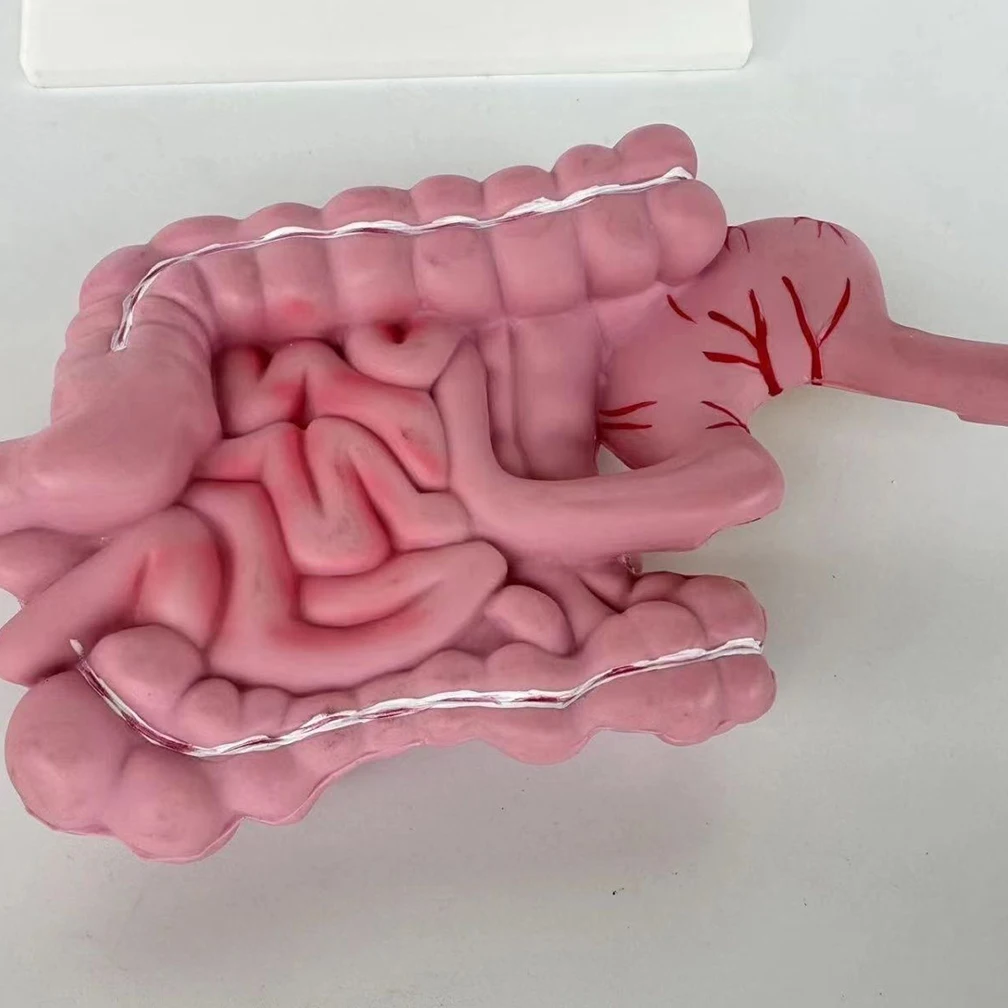 Adult Large Intestinal Pathology Model Human Digestive System Anatomy Model Medical Teaching Tools Gastrointestinal Lesions