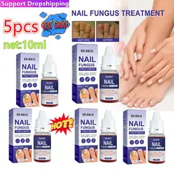 5PCS Nail Fungal Treatment Feet Care Essence Anti Infection Paronychia Onychomycosis Nail Repair Toe Fungus Serum Fungal Removal