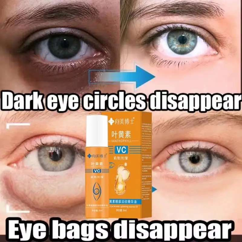 VC-aceite de esencia para ojos de luteína, bola de rodillo para ojos que elimina las ojeras, borrador de embotamiento, bolsa para ojos que se desvanece, esencia nutritiva para ojos de línea fina