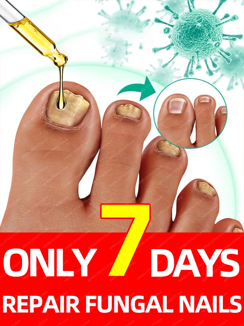 

Destroy nail fungus and sterilize your nails with this.