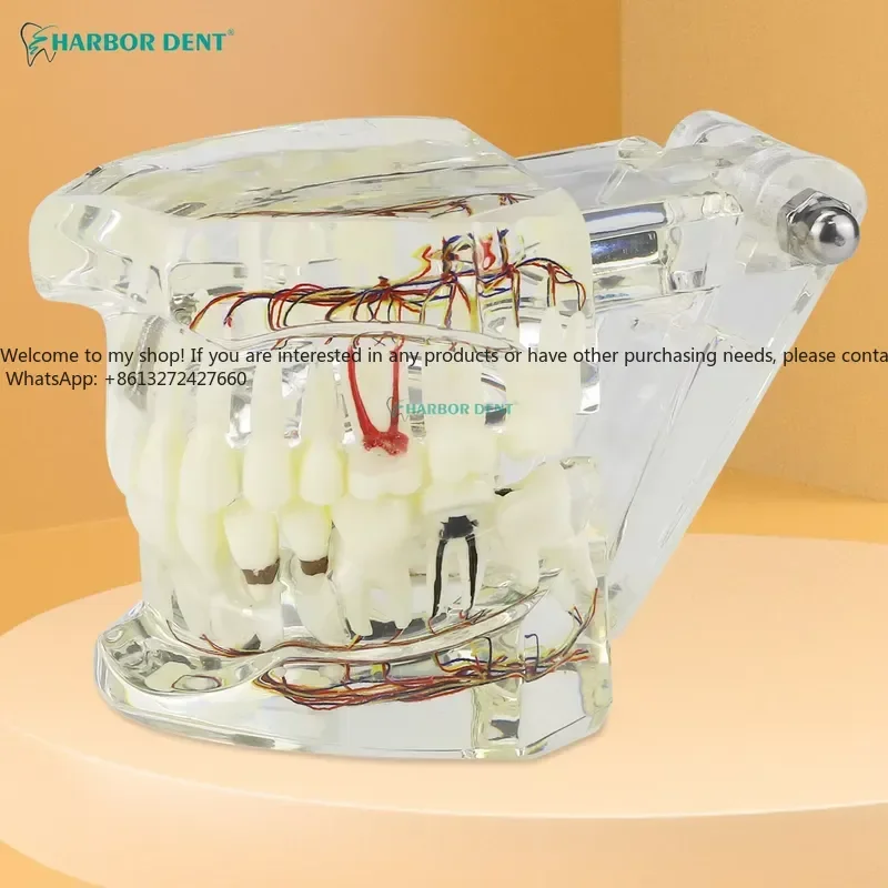 Restoration Bridge Teaching Study Medical Science Disease Teeth Model for Dentist