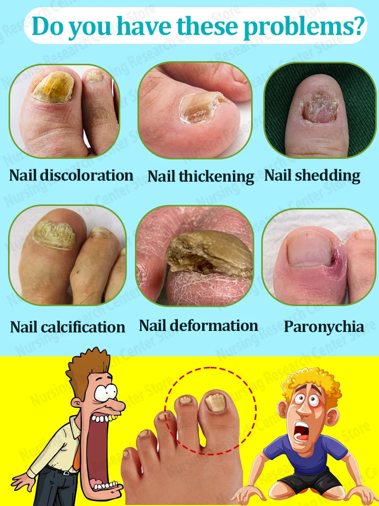 Eliminate nail problems