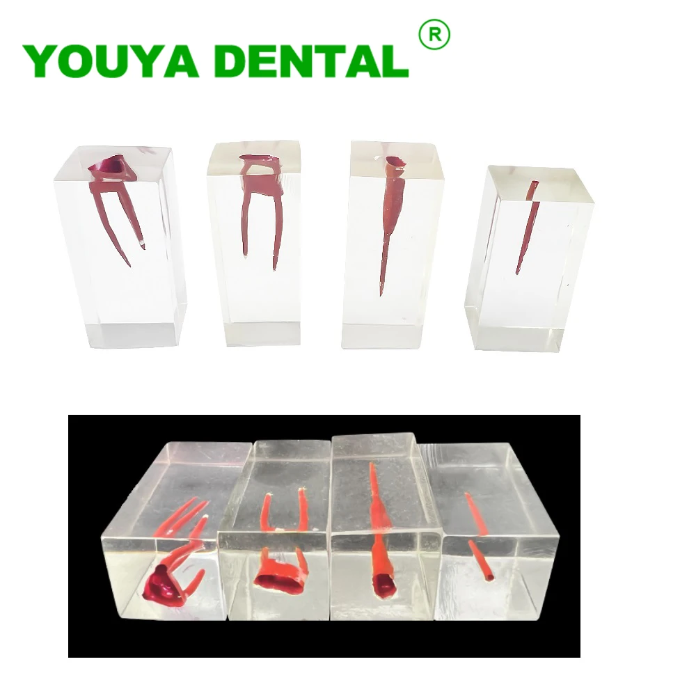 

1pc Dental Endodontic Model Root Canal Block Teeth Pulp Cavity Practice Training Tooth Model Dentistry RCT Demo for Teach Study
