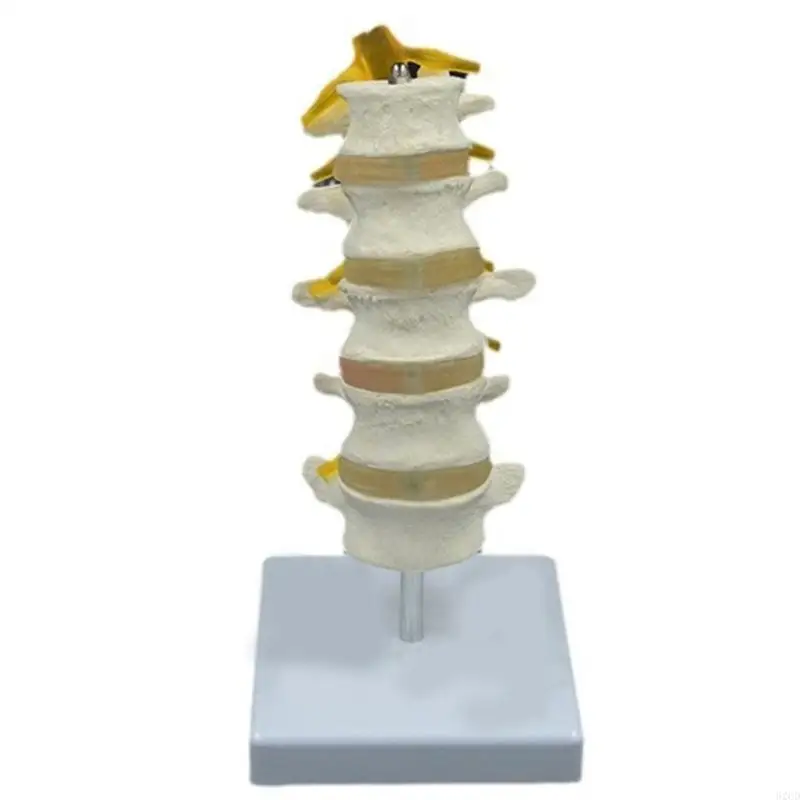 Anatomical Lumbar Spine Model Human Lumbar Vertebrae Model with 5 Vertebrae Sacrum and Spinal Nerves for Demonstrating