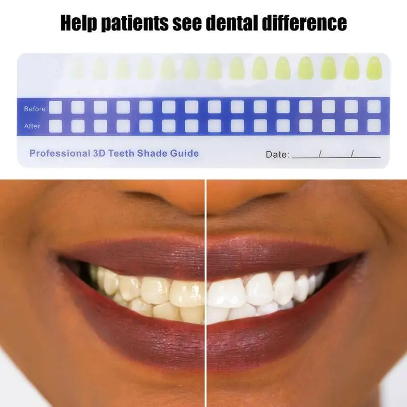 Panduan Warna pemutih gigi, 5 buah untuk penggunaan di rumah-Tooth Shade Chart