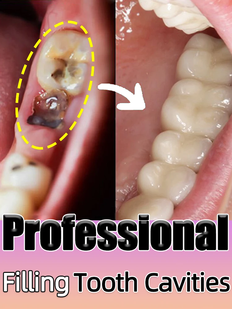 Cavity filling tooth regeneration