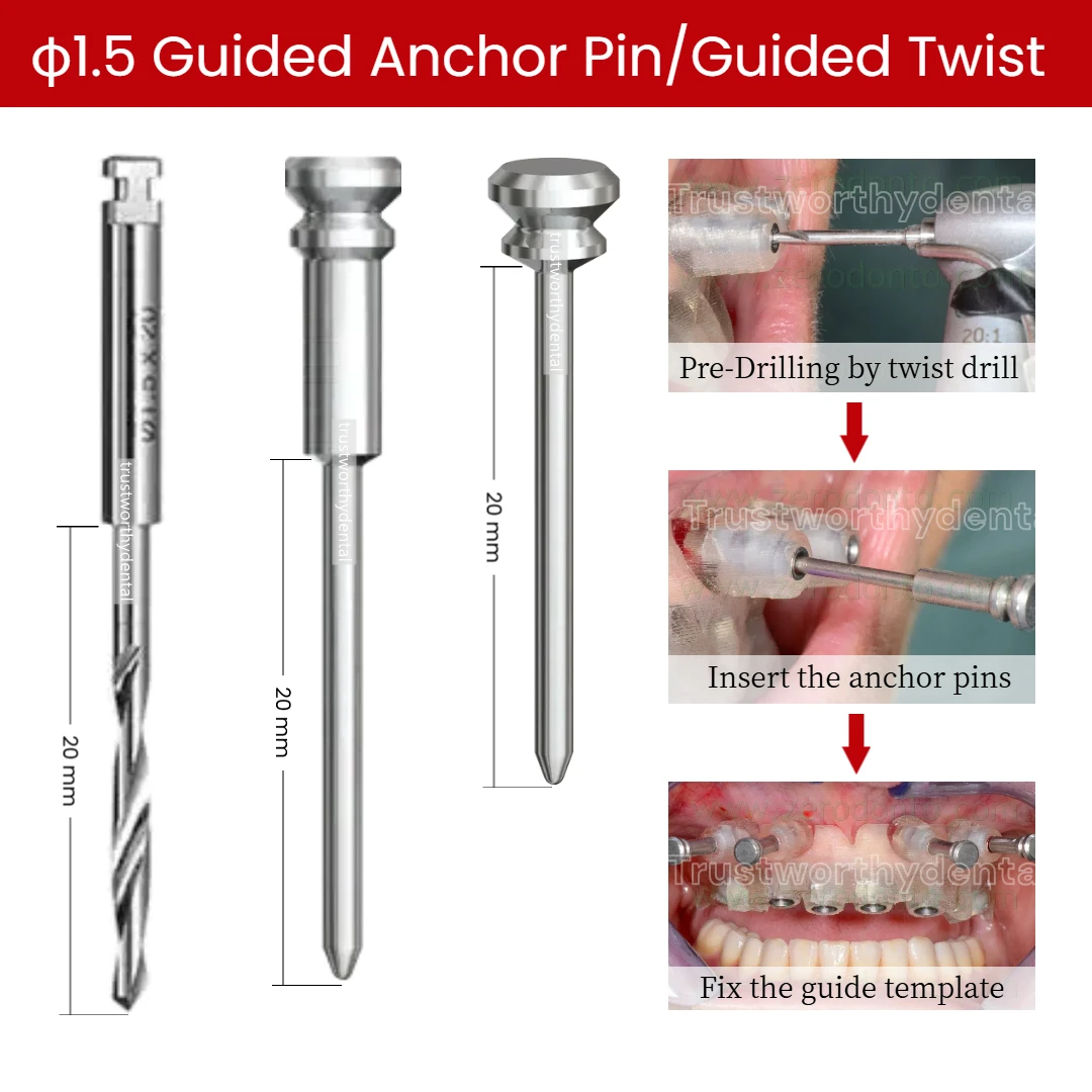 Φ1.5x20 Dental Guided Anchor Pin Guided Twist Drill Long& Short Shaft Guided Implant Fixation Pin Template Fixation Pins Kit