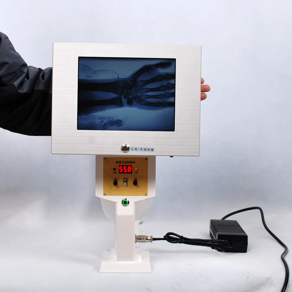 Portable X Ray Machine C Design High-definition Black and White Images Fluoroscopy X-ray System