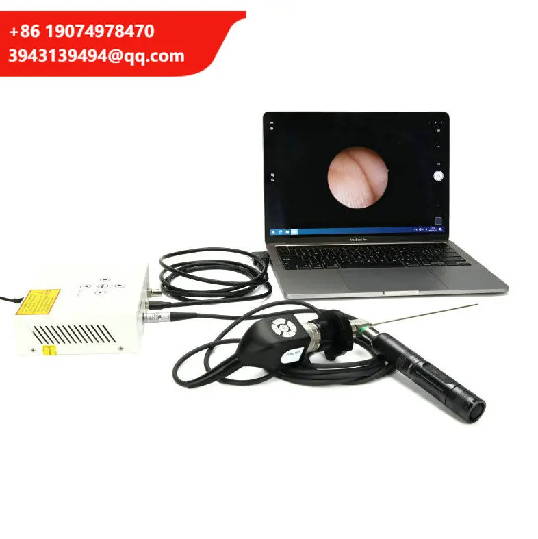 Medical Cheap Ear Endoscope Camera Nasal Usb Otoscope Camera Portable Hd Endoscope Camera System