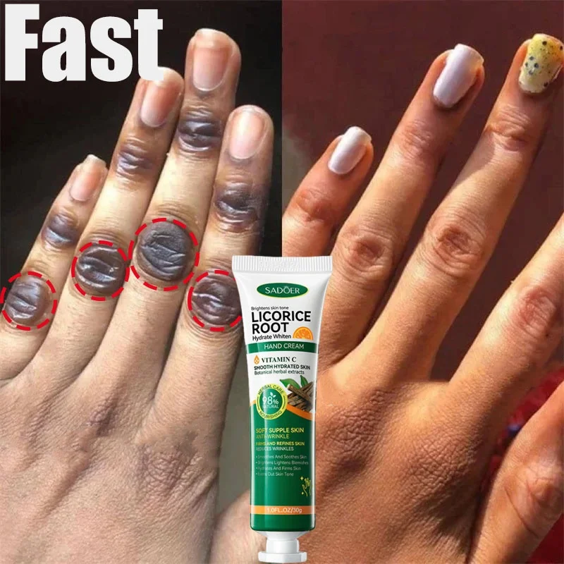 

Fast Whitening Dark Knuckles Brighten Hand Cream Melanin Corrector Moisturizing Intense Stains Remover Products Skin Care