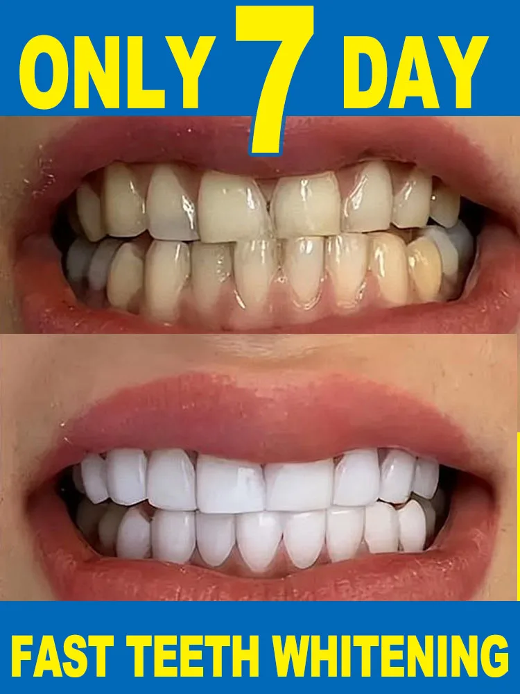 

Fast and effective teeth whitening tooth protection products