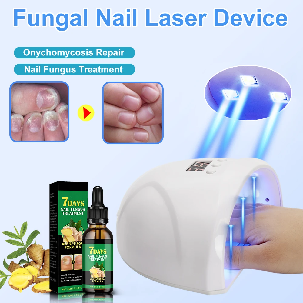 Fungal Nail Laser Device Repair Fast Nails Fungus Onychomycosis Repair Toenail Fingernail Removes Nail Fungus Foot Care Device