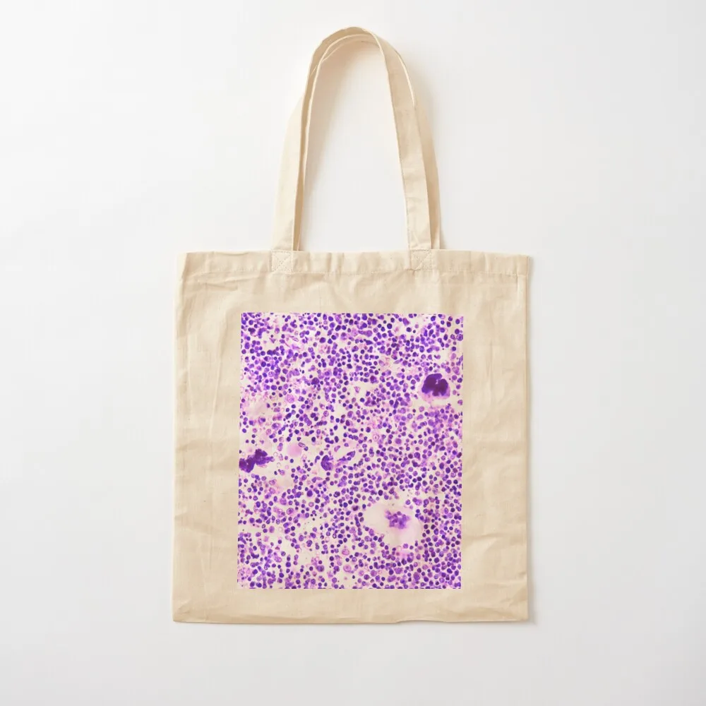 

Bone marrow Tote Bag Candy bags Shopping bags Canvas Tote Bag