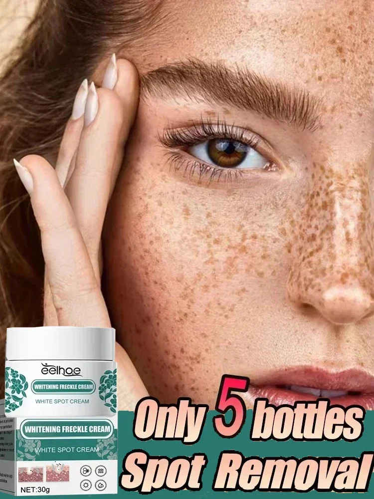 

Effective Freckle Cream Fast Brighten Face Remove Melasma Dark Spot Fade Melanin Whiten Anti-pigmentation Improve Dullness