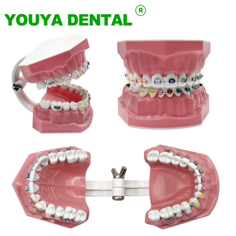 

Dental Typodont Orthodontic Model With Half Metal Half Ceramic Braces Teeth Model Demonstration Tools For Patient Communication