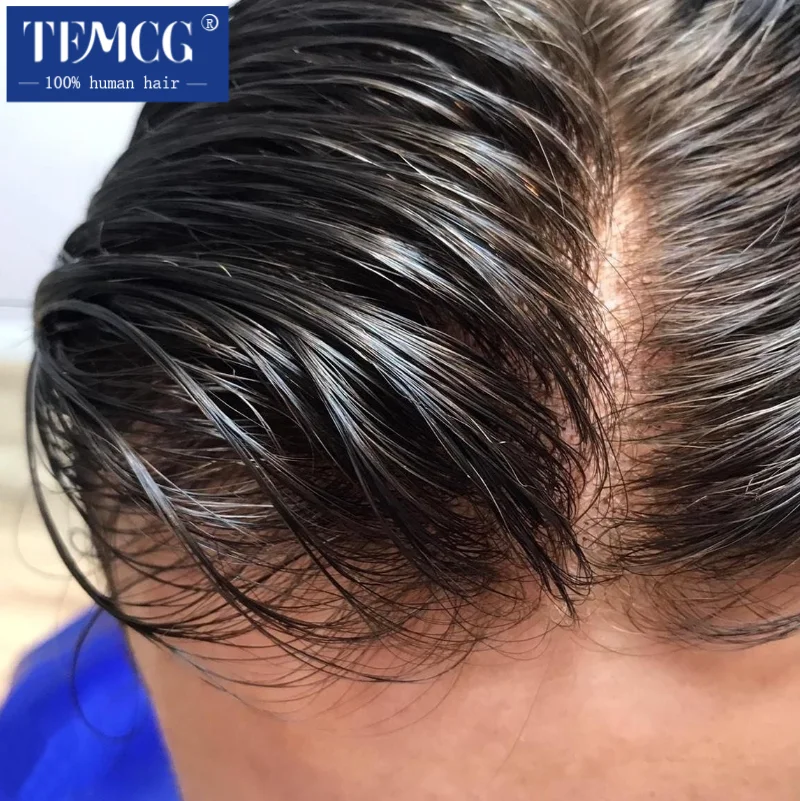الرجال الشعرية الاصطناعية 0.02-0.03 مللي متر رقيقة الجلد الذكور الشعر الاصطناعية 100% شعر الإنسان شعر مستعار للرجال نظام استبدال الباروكات للرجال #1