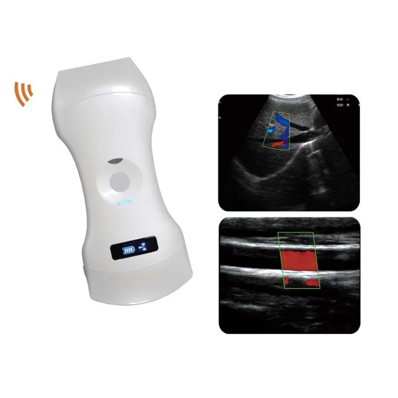 cheap price wireless medical wholesale high resolution display handheld ultrasound scanner portable ultrasound device