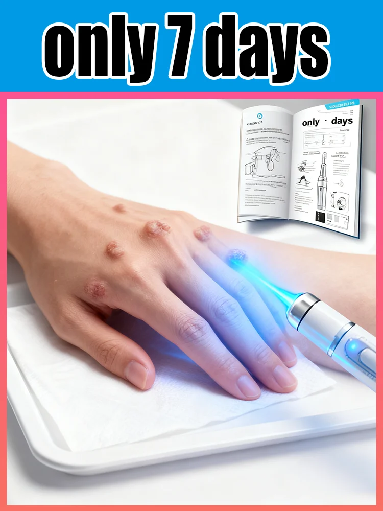 ʙʟᴜᴇ ʟɪɢʜᴛ ᴘᴇɴ sᴏʟᴠᴇ ᴡᴀʀᴛs, ʜᴏᴛ sᴀʟᴇ ᴡᴀʀᴛ ᴄᴀʀᴇ ᴛᴏᴏʟs