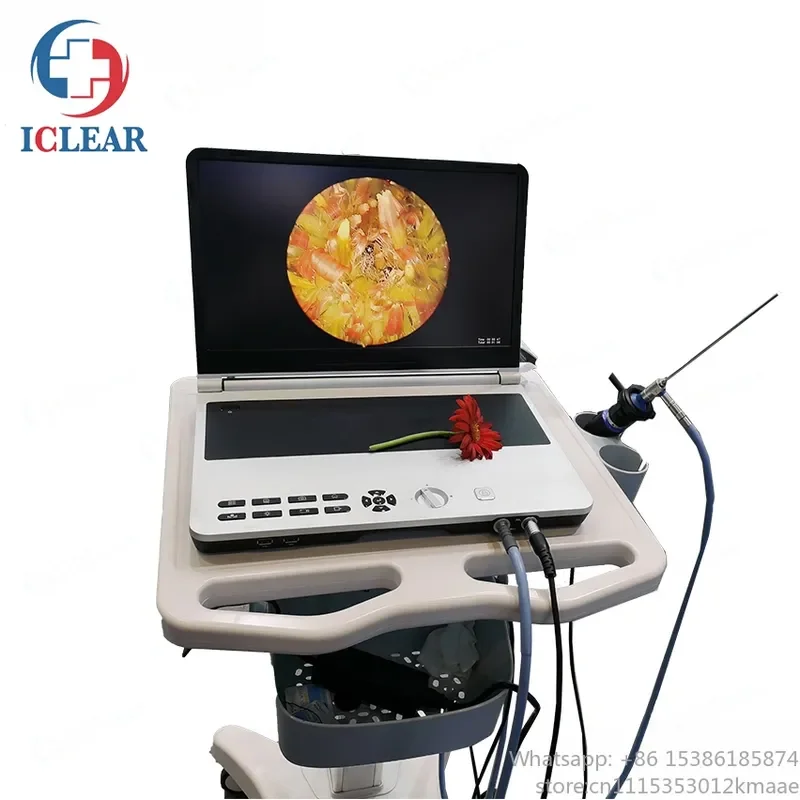All-in-One 4K HD Integrated Endoscope Camera System for Medical Imaging