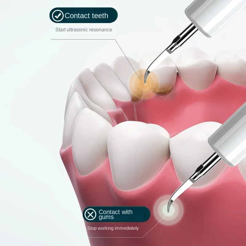 Épurateur Dentaire Électrique, Outil de Soins Dentaires, Instrument de miles des Dents, Nouveauté