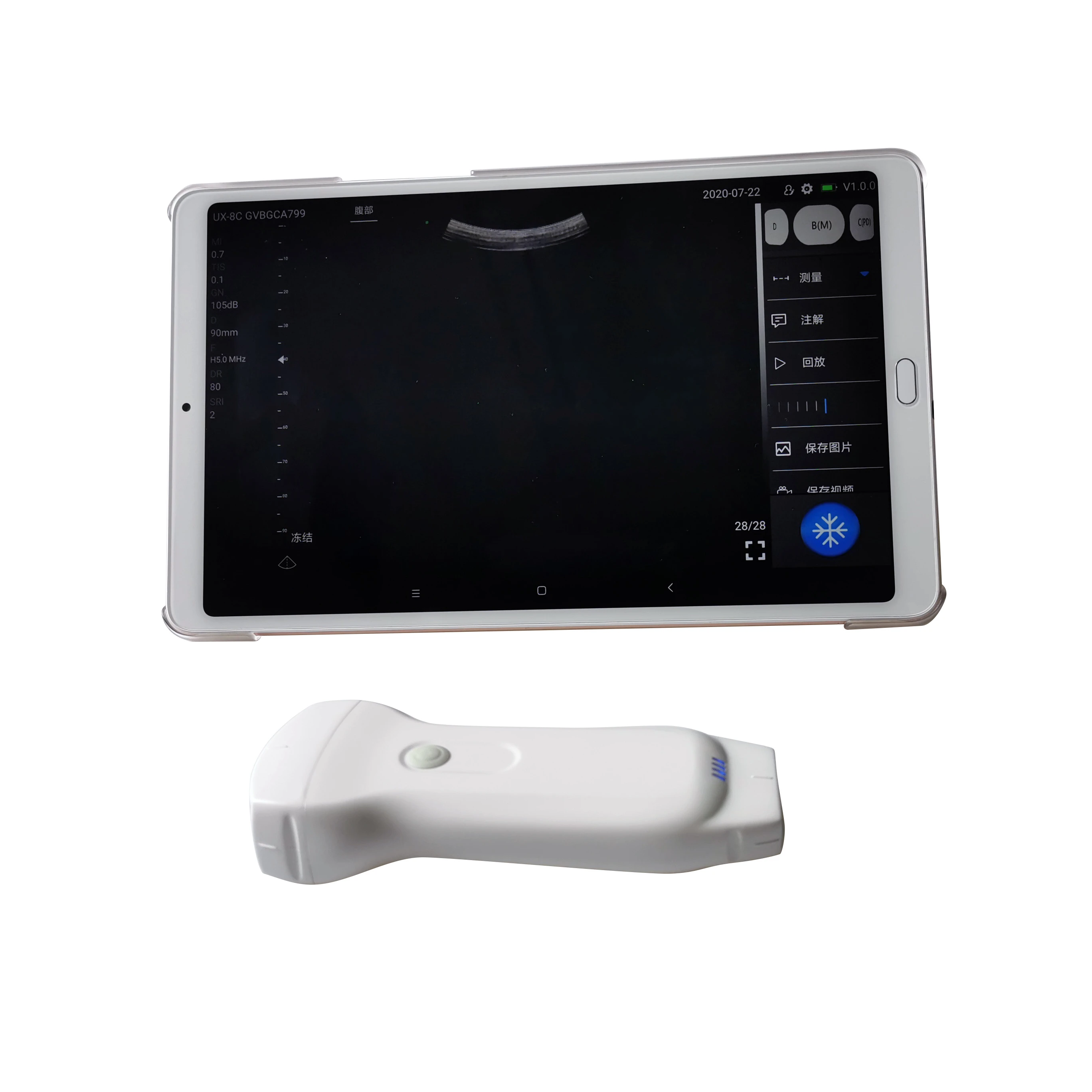 

wireless android/ios usb ultrasound probe dual head ultrasound scanner 3 in 1 convex linear phased array pocket ultrasound