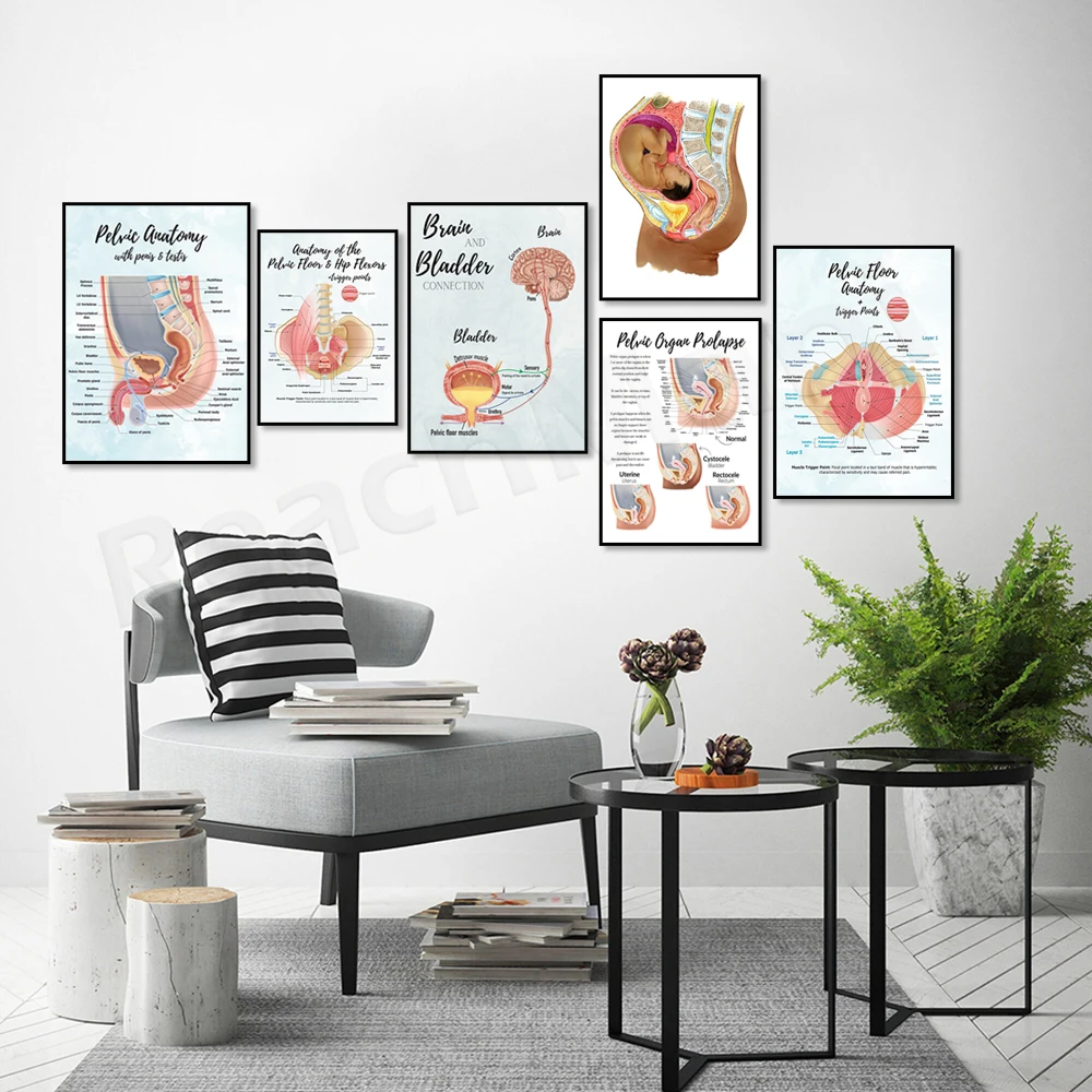 Brain and bladder educational poster, sagittal side view, rectum, pelvic floor and hip flexor + trigger point anatomy poster
