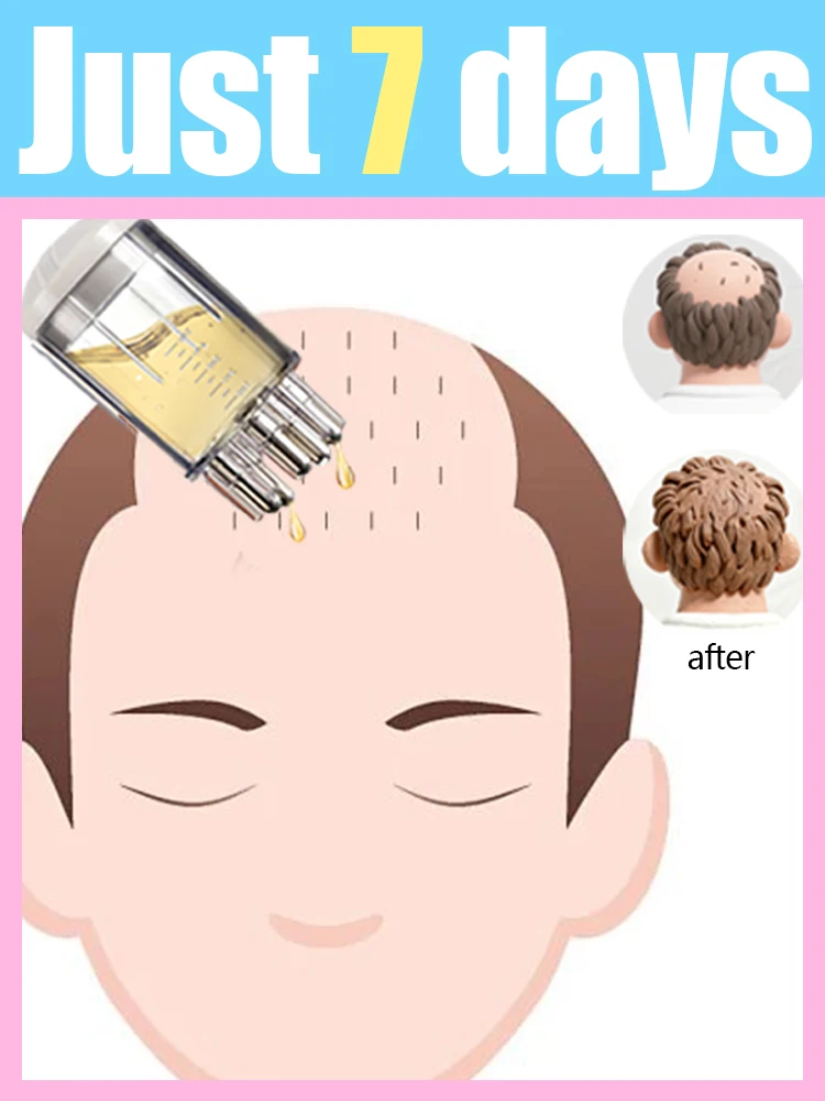 

Latest model New upgrade Liquid massage comb Scalp applicator. Use with hair growth oil.