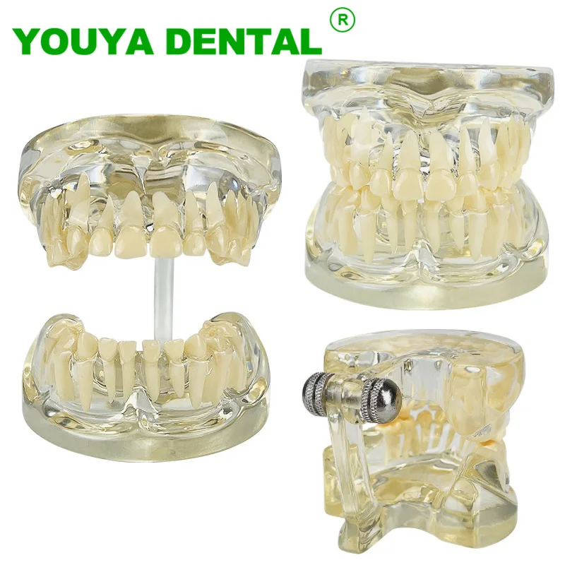 

Child Dental Model Standard Teeth Teaching Education Training Demonstration Model Dentist Dentistry Laboratory Product