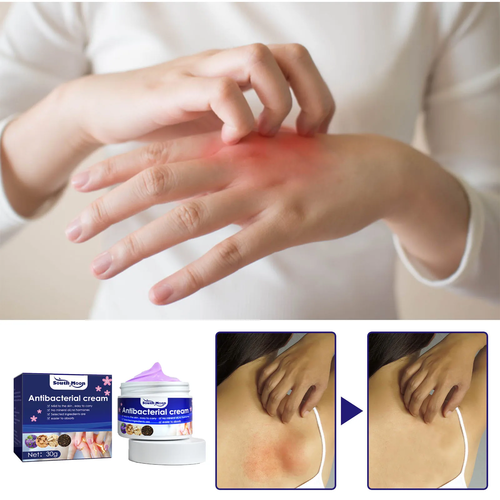 south moon Violae Herba Skin Anti-itch Cream, Anti-Bacteria Topical Mosquito Bites Skin Itching and Anti-Itching Cream