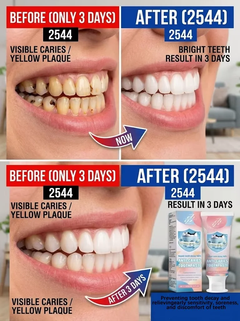 1 PC Anti Decay Toothpaste, Deeply Disintegrates Stubborn Smoke and Tea Stains, Black and Yellow Tartar for 10 Years, Whitens and Brightens Teeth Without Damaging Enamel, Removes Bad Breath and Leaves a Mint Fragrance. Brush It in the Morning and Evening