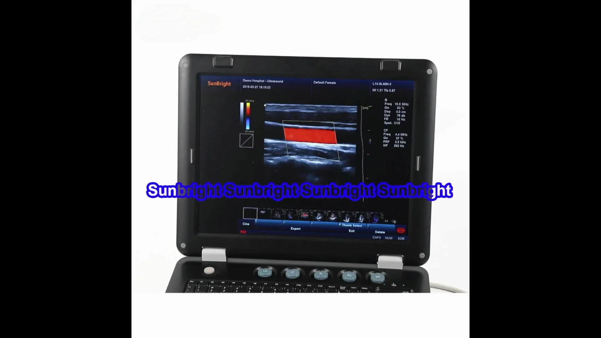 Hip test MSK doppler ultrasound vascular with linear probe