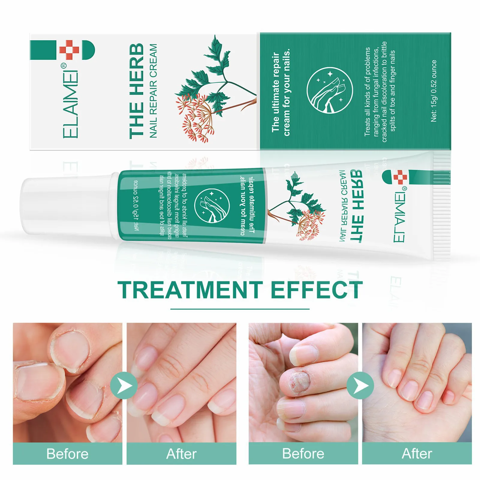 Reparação de unhas creme nutritivo forte reparação unha creme fortalecer unhas conveniente para usar unha natural polonês para unhas de dedo