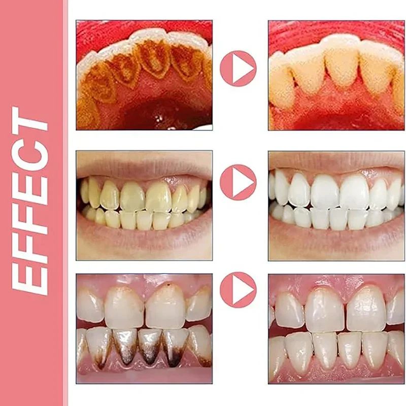 SP-6 Probiotic Toothpaste Remove Plaque Stain Whiten Teeth Protect Gum Teeth Oral Hygiene Clean Fresh Breath Dental Care Product