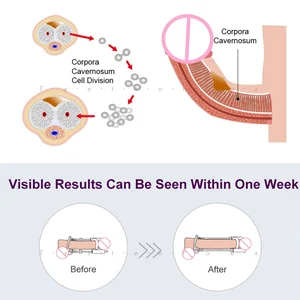 القضيب الموسع واستبدال قضيب برغي الحزام ، مضخة القضيب ، تكبير الملحقات ، 3rd الجيل حافة التوتر ، نقالة ، محسن أعلى 12 استبدال مبيعات القضيب موسع - No4