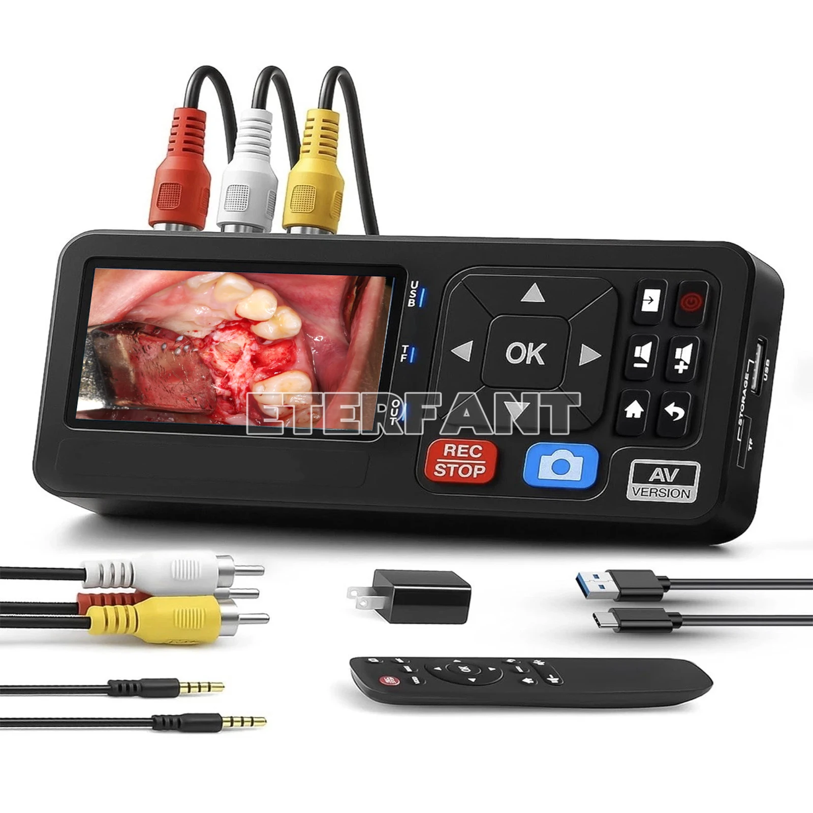 

Portable Medical Surgical Recorder for Laparoscopy and Endoscopy Capture HD50, Supports FAT32, EXFAT,Gpt,MBR and NTFS Formats