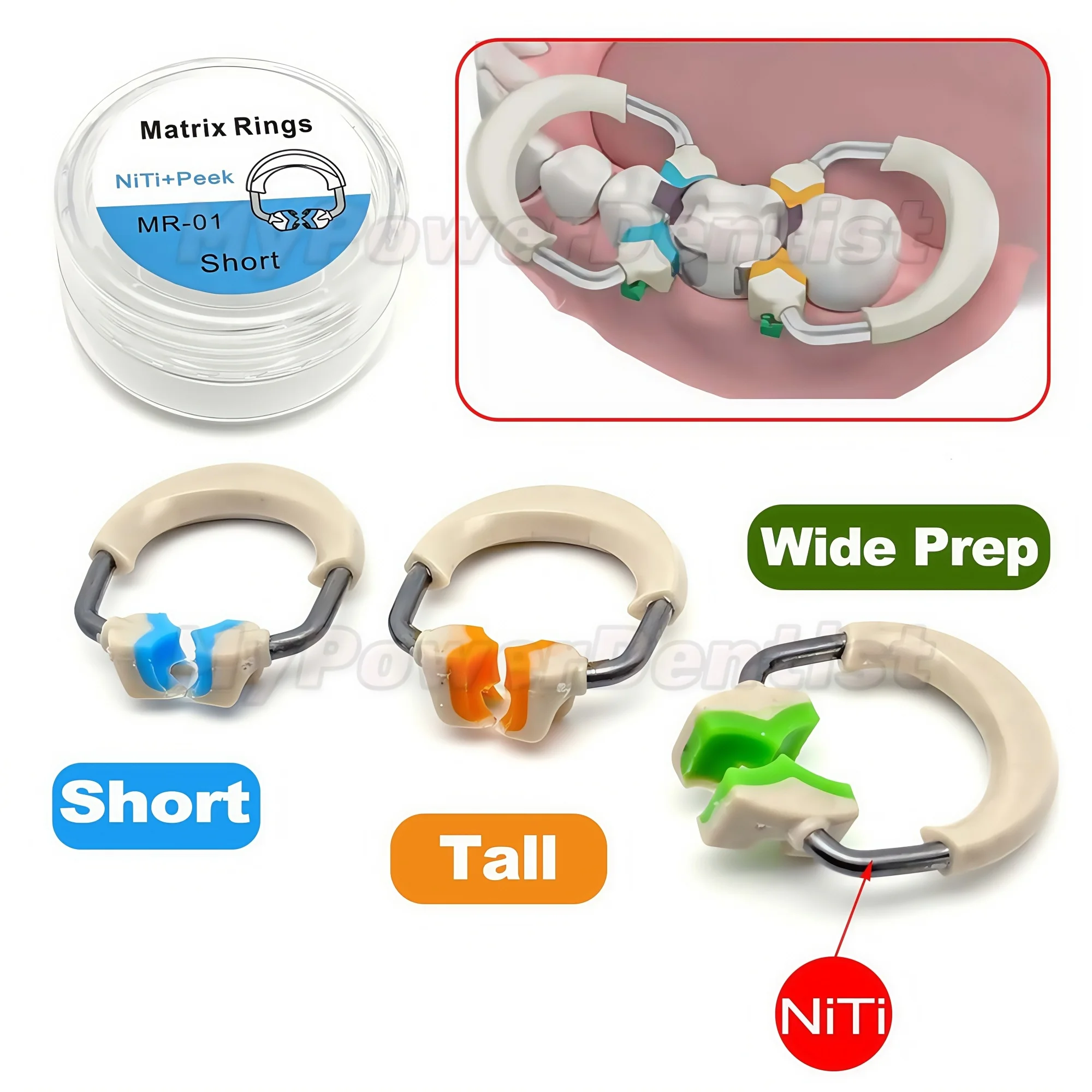 

Dental 3D Separator Matrix Bands Rings Matrices Clip Clamp Titanium Fit Garrison