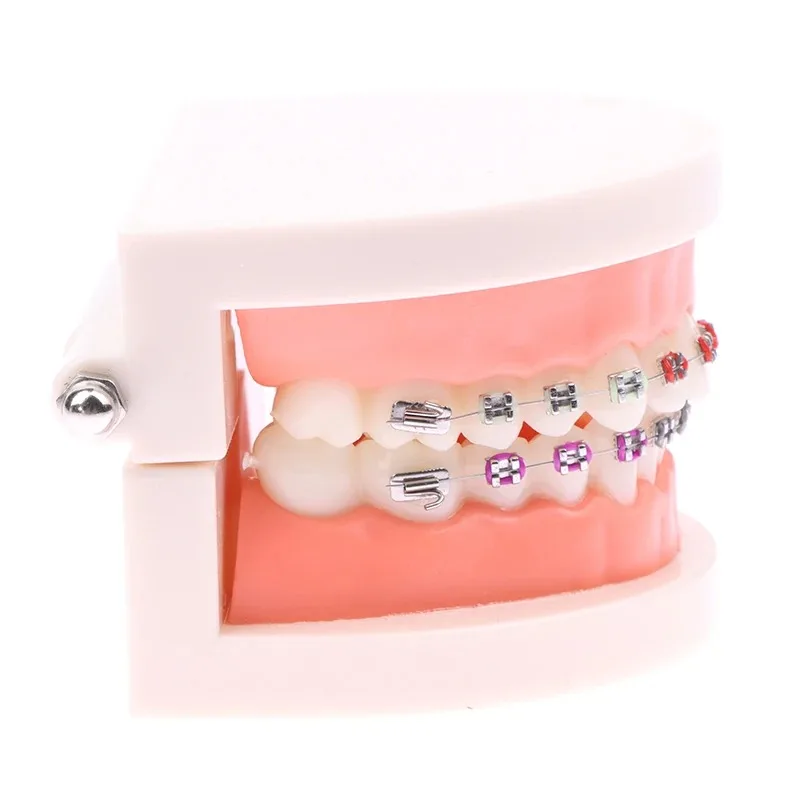 Modelo de tratamiento Dental de ortodoncia, modelo de dientes Typodont para enseñanza, estudio, soportes de Metal/cerámica, lazos de ligadura de alambre de arco, 1 unidad